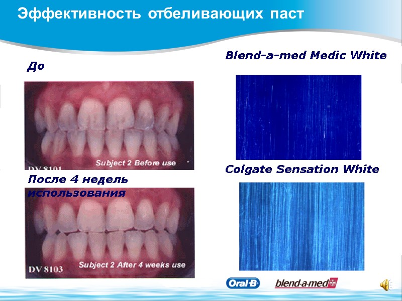 Эффективность отбеливающих паст После 4 недель использования  До  Blend-a-med Medic White 